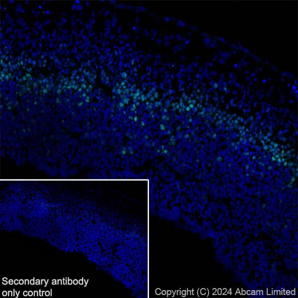 Anti-TBR2 / Eomes antibody [RM2055](AB319166)
