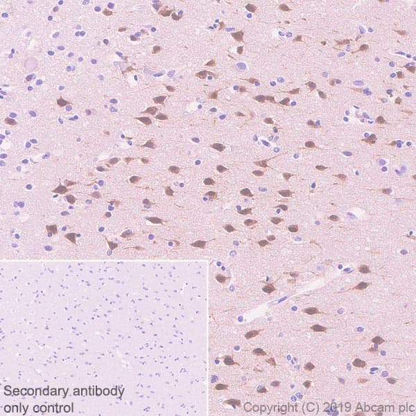 Fos B Antibody Epr23489 90 Bsa And Azide Free Ab269953  Immunohistochemistry Formalin Pfa Fixed Paraffin Embedded Sections Img17754