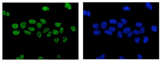 Anti-Retinoic Acid Receptor gamma antibody [EPR2020(N)] - N-terminal(AB187159)