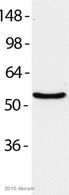 Anti-P4HB antibody [RL90](AB2792)