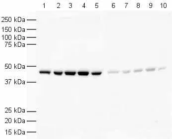Anti-beta Actin antibody(AB8227)
