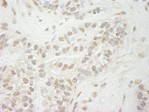 Anti-KDM5B / PLU1 / Jarid1B antibody(AB84883)