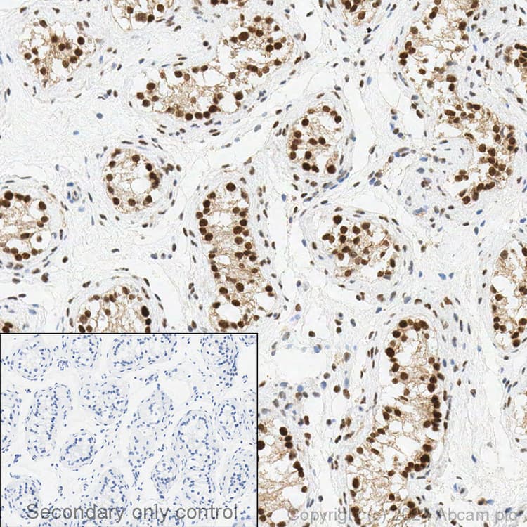 Anti-CDKN2A/p16INK4a antibody [EPR1473] - C-terminal(AB108349)
