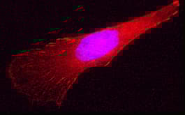 Anti-Talin 1 antibody(AB71333)