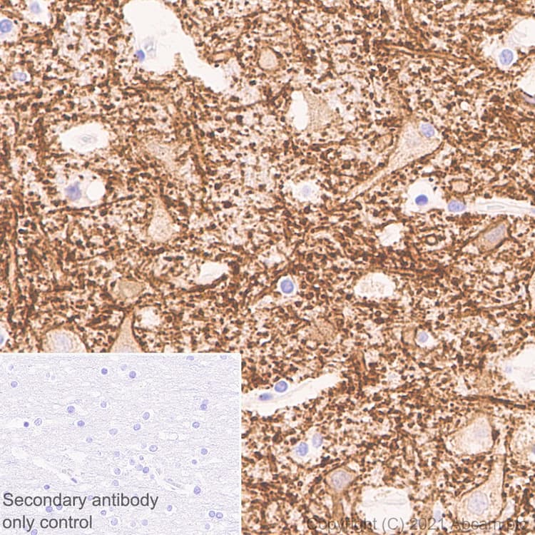 Anti-KCC2 antibody [EPR24203-85](AB259969)