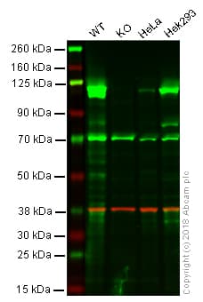 Anti-Rb antibody [EPR17512](AB181616)