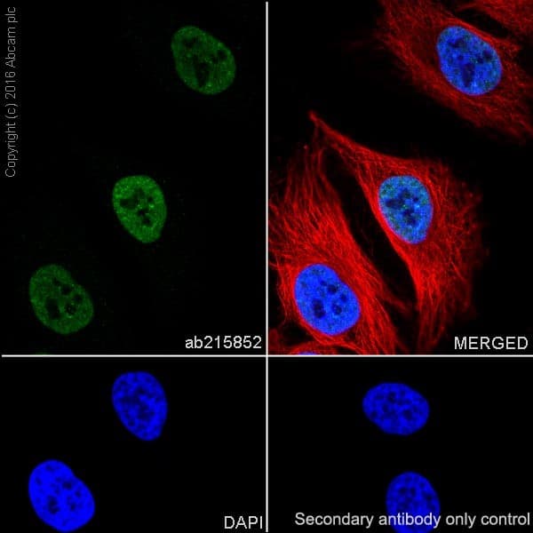 Anti-DBC-1 antibody [EPR19747] - BSA and Azide free(AB223530)