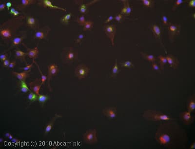 Anti-AGE antibody(AB23722)