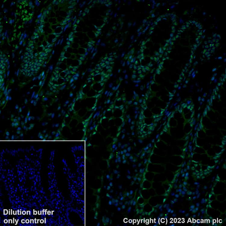 Alexa Fluor 488 Brd4 Antibody Epr51502 Ab197606  Immunohistochemistry Formalin Pfa Fixed Paraffin Embedded Sections Img448807
