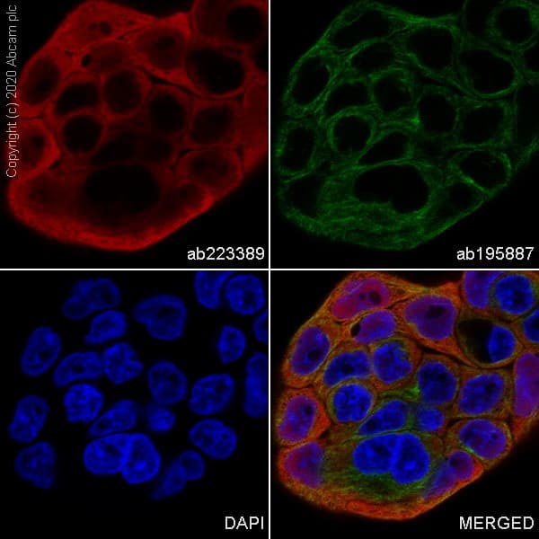 Alexa Fluor® 555 Anti-Hsp70 antibody [EP1007Y](AB223389)
