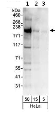 Kmt4 Dot1l Antibody Ab72454  Western Blot Img31928