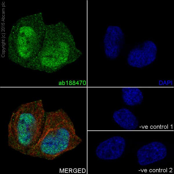 Anti-Dnmt3a antibody [EPR18455](AB188470)