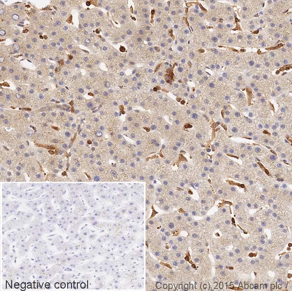 Hrp Vitronectin S Protein Antibody Ep873y Ab199310  Immunohistochemistry Formalin Pfa Fixed Paraffin Embedded Sections Img127526