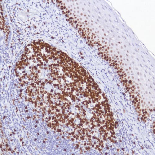 Protein Block(ab64226)