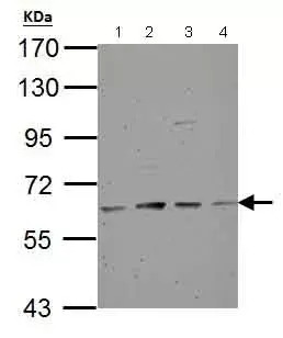 Anti-Tyrosine Hydroxylase antibody(AB137721)
