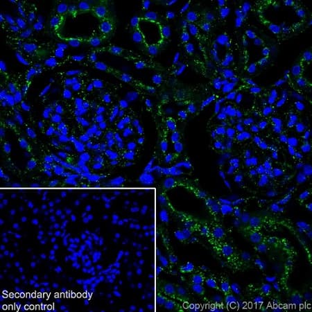 Anti-LAMP1 antibody [EPR21026](AB208943)