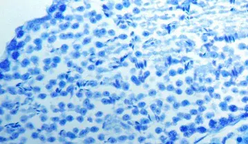 Luxol Fast Blue Stain Kit (Myelin Stain)(AB150675)