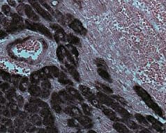 Anti-Desmin antibody - Cytoskeleton Marker(AB15200)