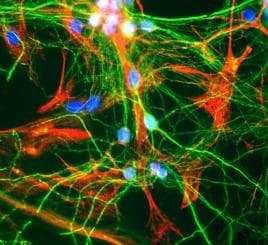 Anti-GFAP antibody [2A5](AB4648)