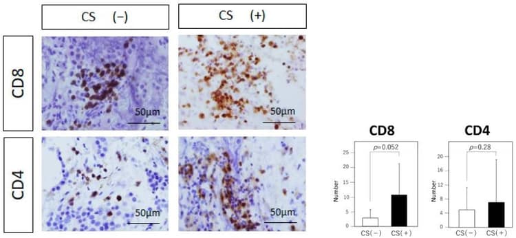 Anti-CD8 alpha antibody [C8/144B](AB17147)