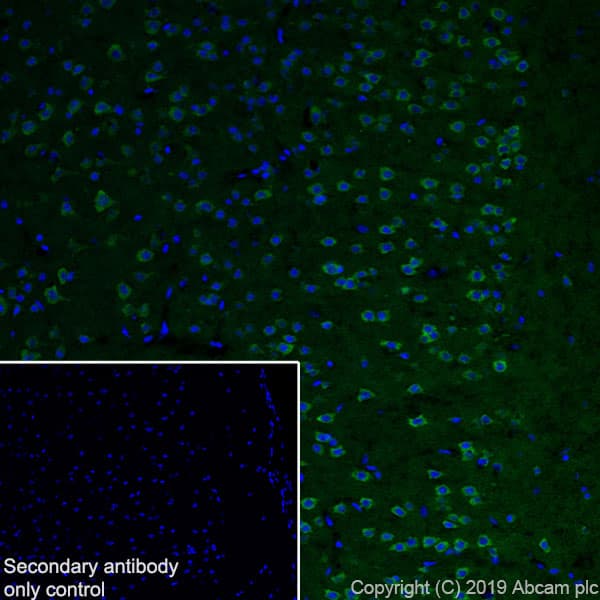 Anti-Huntingtin antibody [EPR5526](AB109115)