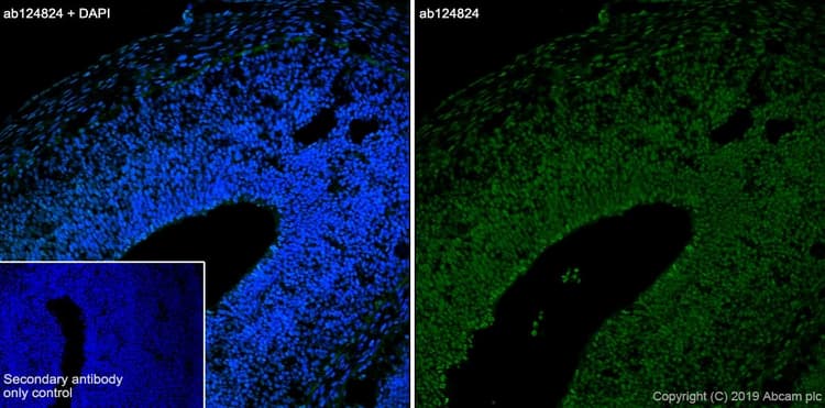 Anti-CXCR4 antibody [UMB2](AB124824)
