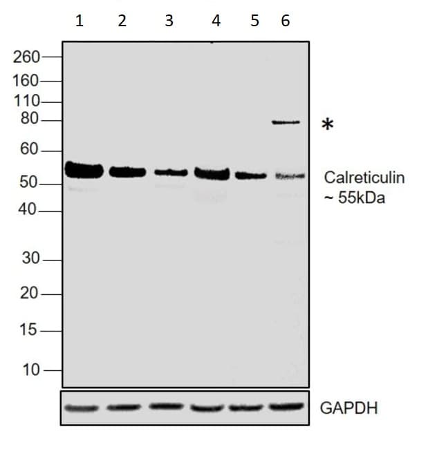 Anti-Calreticulin antibody - ER Marker(AB2907)