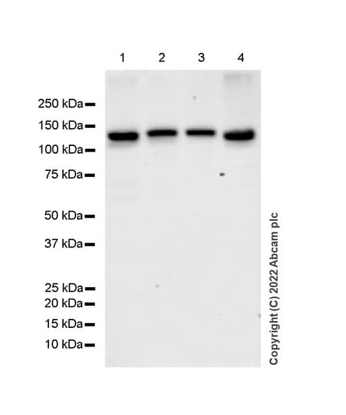 Anti-TYK2 antibody [EPR24628-106](AB303500)