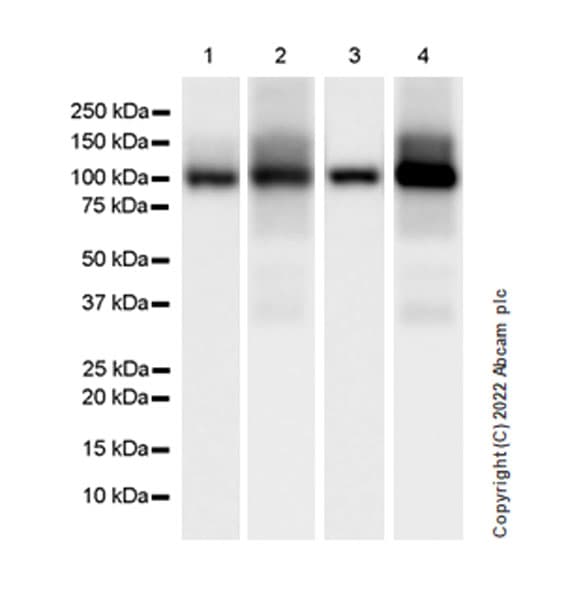 Aldh1l1 Antibody Epr25443 103 Astrocyte Marker Ab307696  Western Blot Img407619