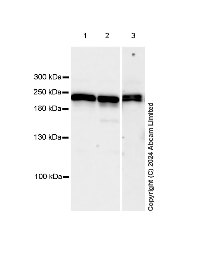 Dnmt1 Antibody Rm1192 Ab317845  Western Blot Img434401