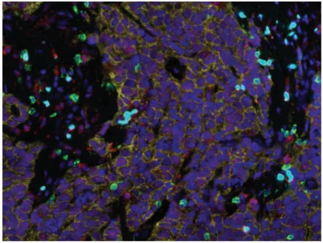 Avidin/Biotin Blocking Kit(ab64212)