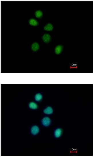 Fes Antibody Ab153841  Immunocytochemistry Immunofluorescence Img77896