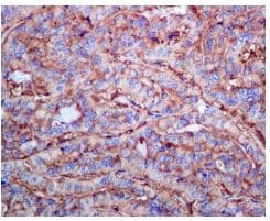 Rpl13 Antibody Epr8828 Bsa And Azide Free Ab248754  Immunohistochemistry Formalin Pfa Fixed Paraffin Embedded Sections Img33871