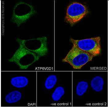 Anti-ATP6V0D1/P39 antibody [EPR18320-38](AB202899)