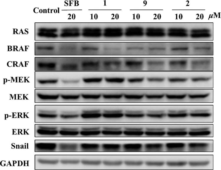Braf Antibody Ep152y Ab33899  Western Blot Img442942