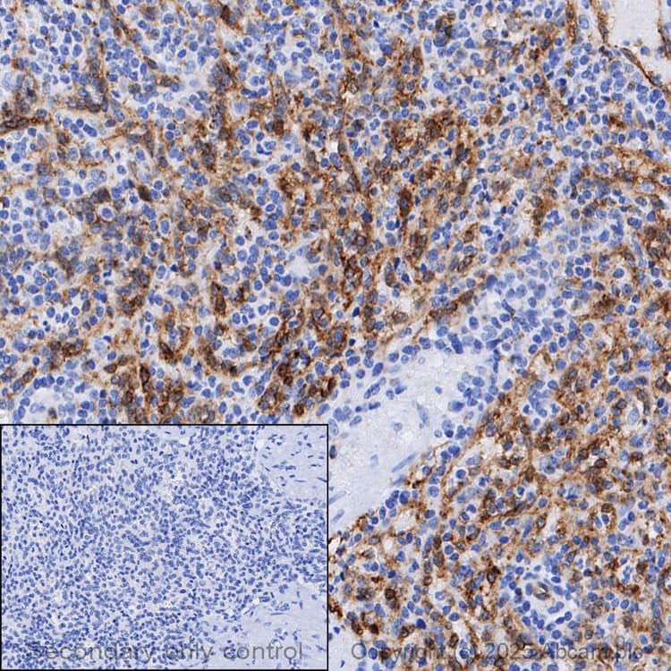 Anti-Claudin 5 antibody [EPR7583](AB131259)