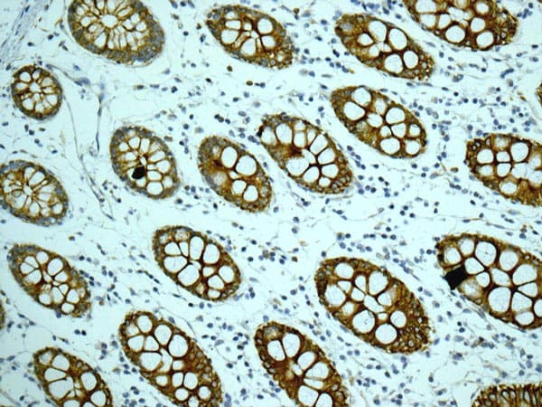 Cyp26a1 Antibody Epr11841 Ab172474  Immunohistochemistry Formalin Pfa Fixed Paraffin Embedded Sections Img88734