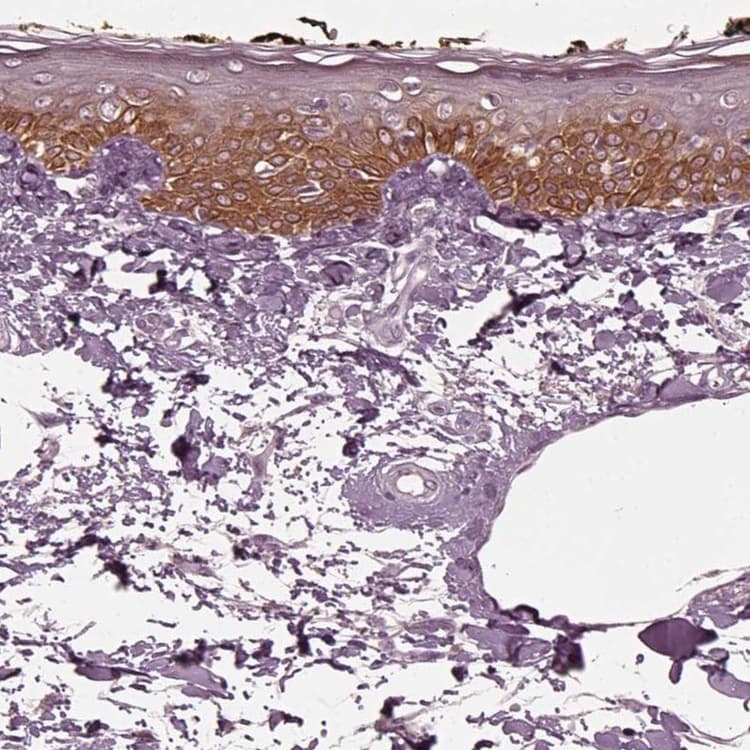 Krt79 Antibody Ab254953  Immunohistochemistry Formalin Pfa Fixed Paraffin Embedded Sections Img128848