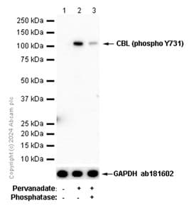 Cbl Phospho Y731 Antibody Ep973y Bsa And Azide Free Ab284695  Western Blot Img435132