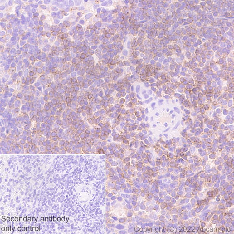 Il 6r Antibody Epr26370 132 Bsa And Azide Free Ab300582  Immunohistochemistry Formalin Pfa Fixed Paraffin Embedded Sections Img400662