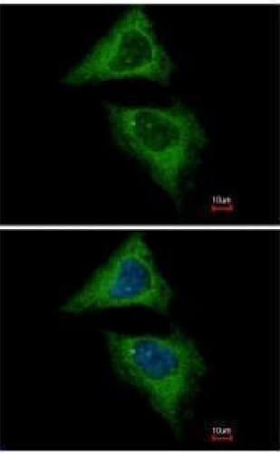 Anti-Dynamin 2 antibody(AB227192)
