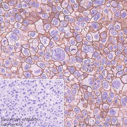 Anti-CD9 antibody [EPR23105-125](AB263019)