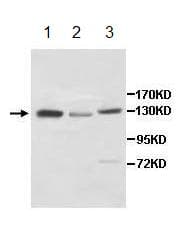 Pcb Antibody Ab196277  Western Blot Img18319
