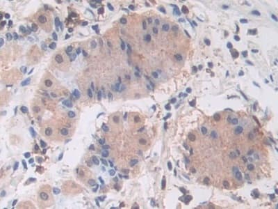 Anti-PI3 Kinase p110 beta antibody(ab232997)