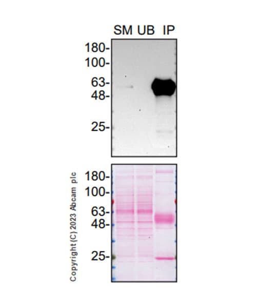 Smoc1 Antibody Epr26922 31 Ab313571  Immunoprecipitation Img418234