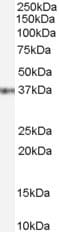 Gbx2 Antibody Ab109726  Western Blot Img100349