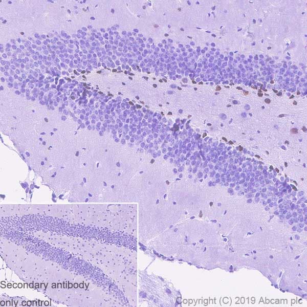 Sox1 Antibody Epr23041 60 Bsa And Azide Free Ab263870  Immunohistochemistry Formalin Pfa Fixed Paraffin Embedded Sections Img22107
