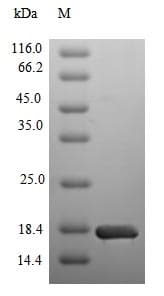Recombinant Human SGLT2 protein (Tagged)(ab236175)