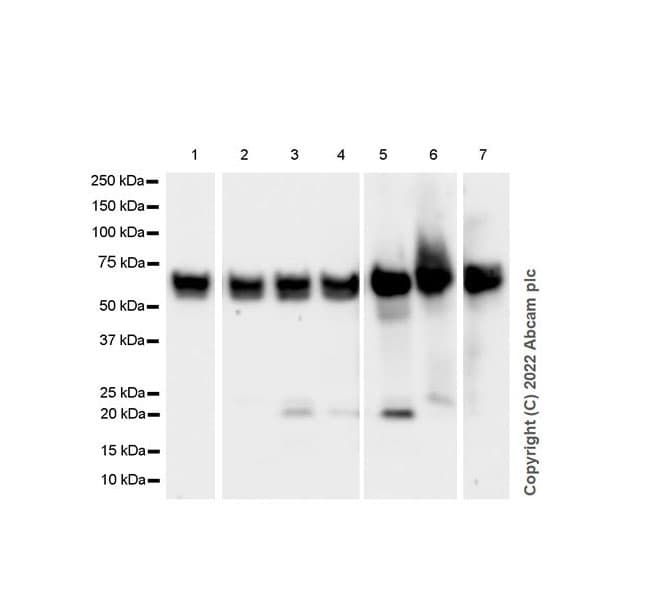 Anti-PAK1 antibody [EPR26067-45](AB302506)
