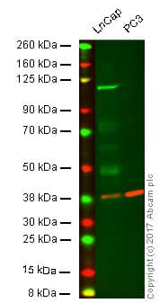 Anti-Androgen Receptor antibody [ER179(2)] - ChIP Grade(AB108341)